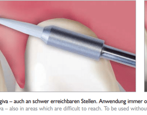 Meisinger Gingiva Trimmer GT135 FG 016 L 8.0