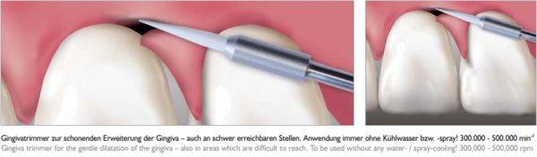 Meisinger Gingiva Trimmer GT135 FG 016 L 8.0