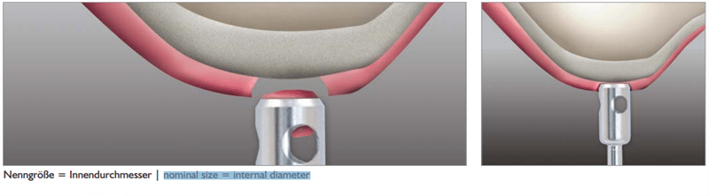 Meisinger Tissue Punches 225RF HP Stainless Steel