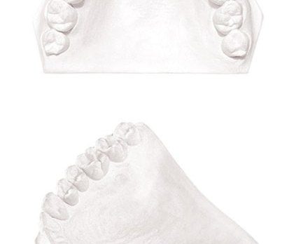 GARRECO Dental Plaster 25lb or 50lb, ALL TYPES