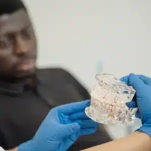 Impression Materials & Accessories