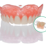 Karadent by TCS / Large / Shade (2) Standard Pink - 28mm