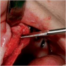 Meisinger Horizontal-Control