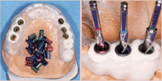 Meisinger Bone Management 3D-Navigation-Control - Meisinger Germany