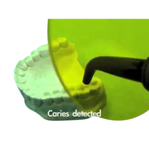 Dentmate Ledex WL-090+ Plus LED Curing Light